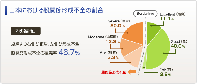 日本における股関節形成不全の割合