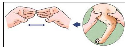 左右の大腿周囲径の比較