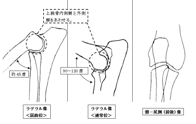 肘関節の撮影法