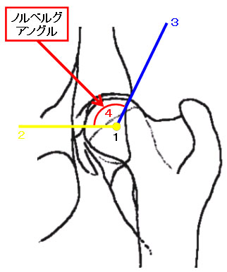 股関節伸展腹背方向のX線撮影法