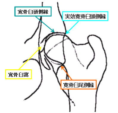 寛骨臼